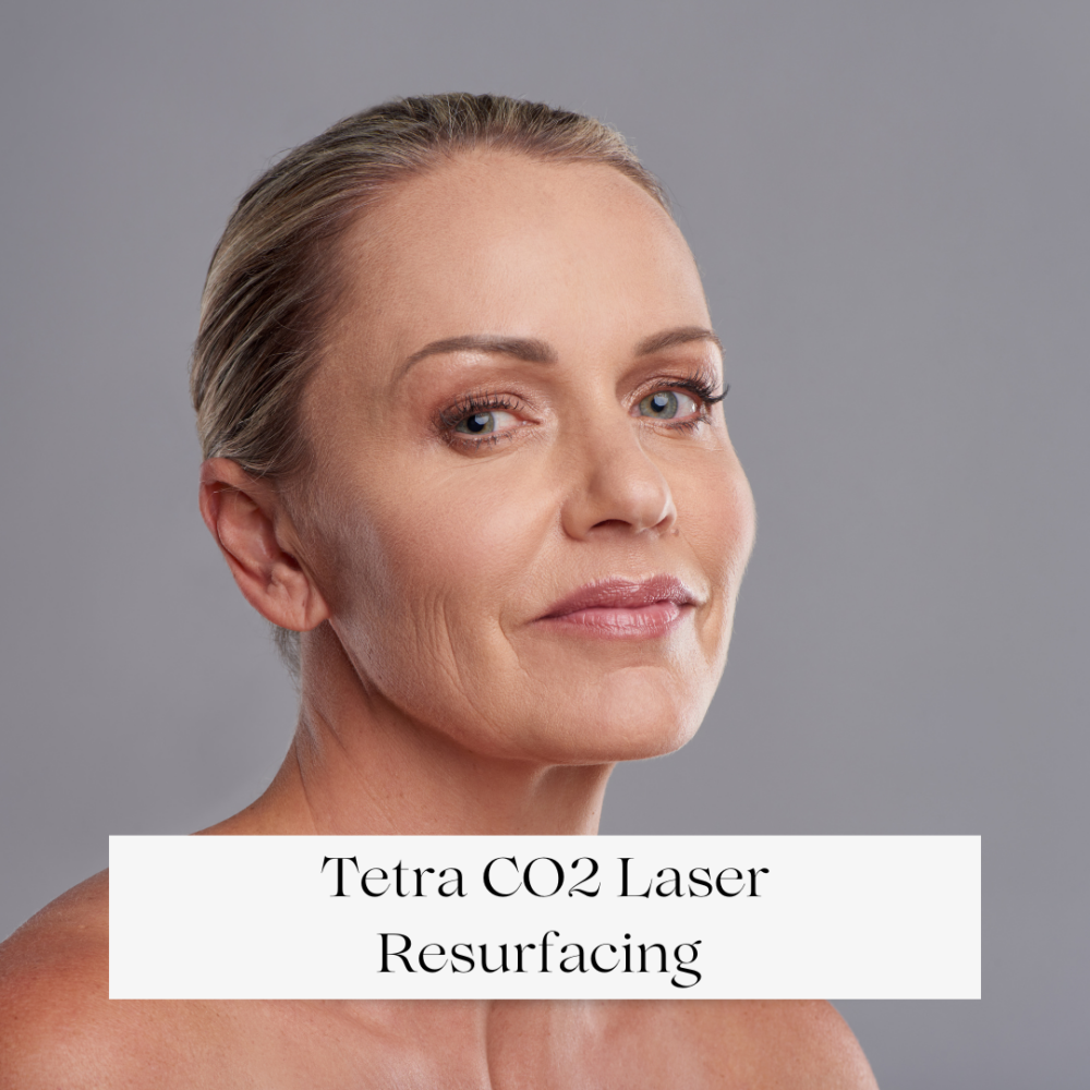 Tetra CO2 Laser Resurfacing